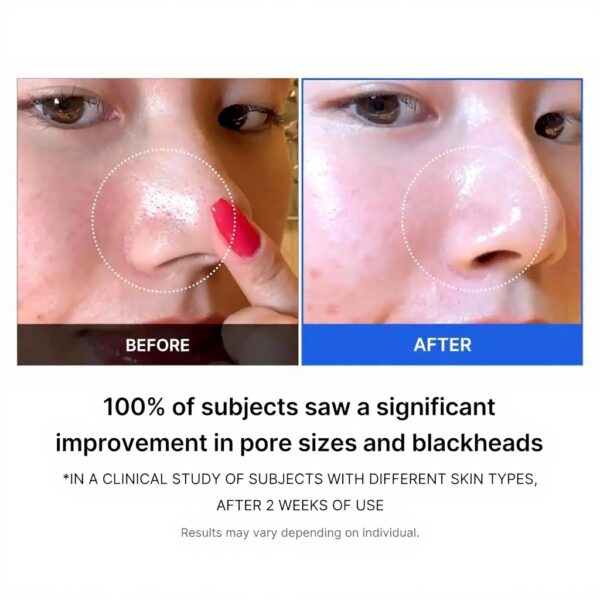 MEDICUBE Zero Pore Pad 2.0 Reinigungspads Hautpflege